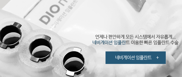 네비게이션 임플란트