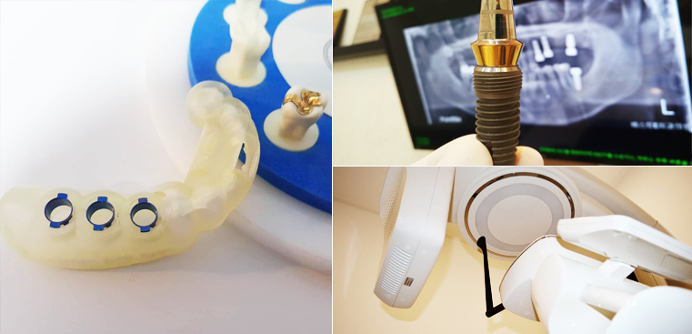 수준 높은 의료장비 보유 백년치과