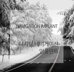 네비게이션 임플란트