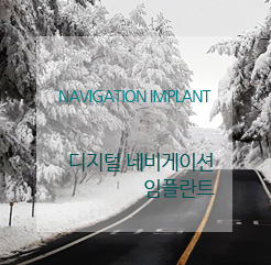 디지털 임플란트