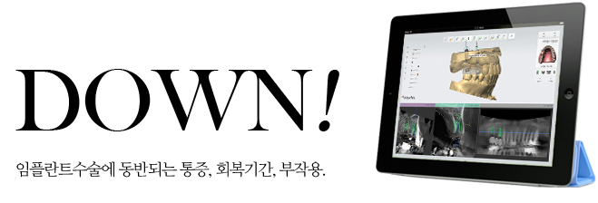 백년치과 임플란트